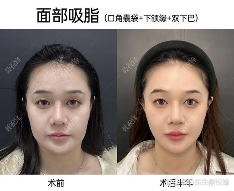 面部轮廓