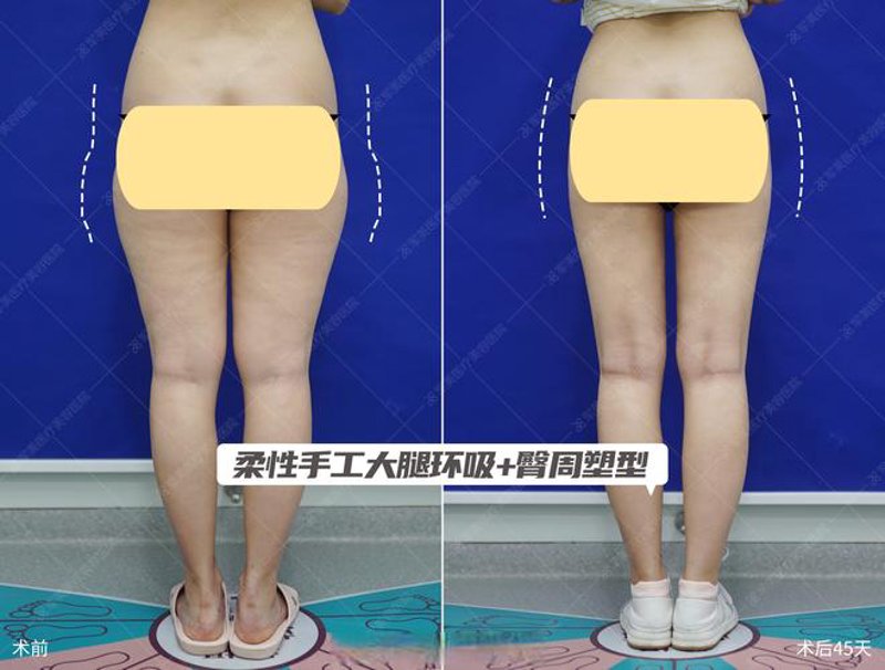 沈阳整形外科：引领美丽新潮流