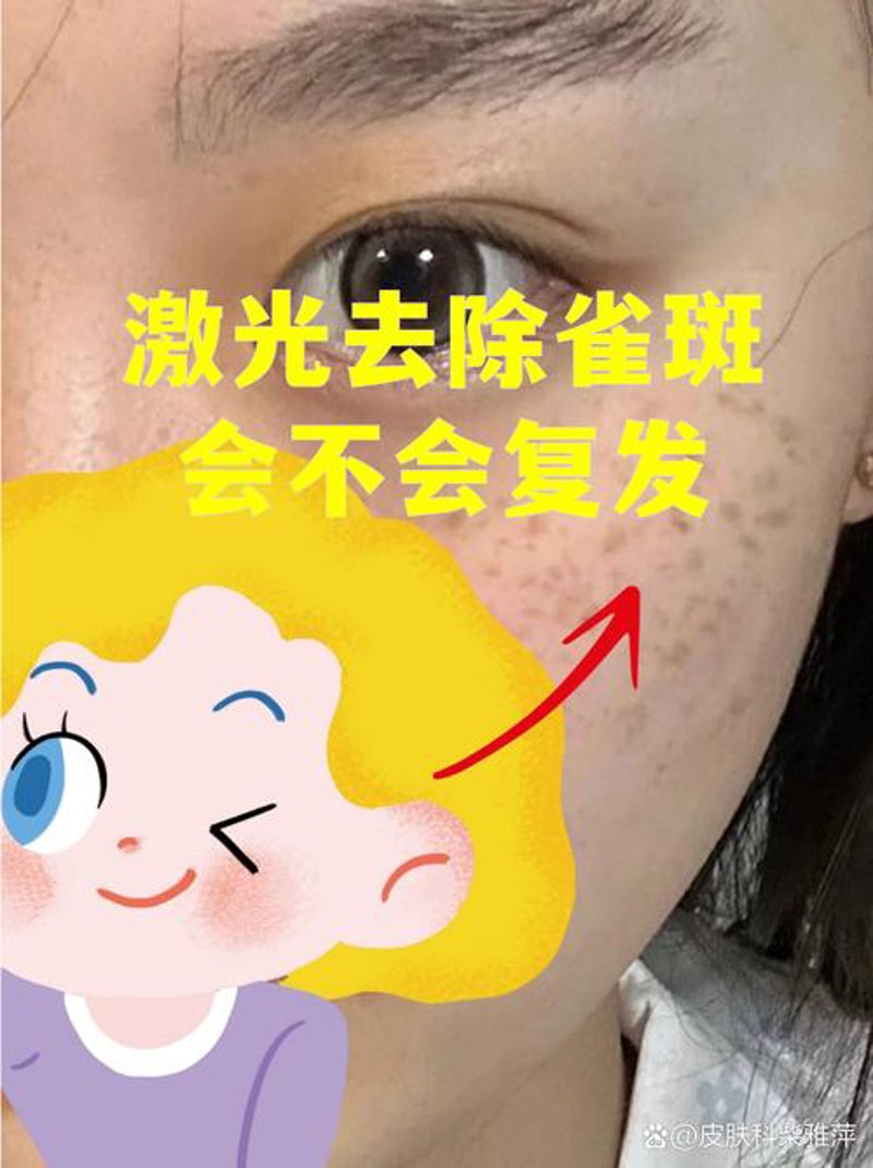 隆胸